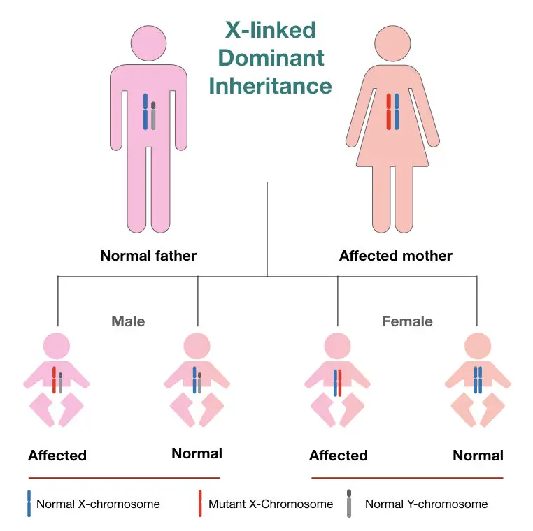 The inheritance pattern of X-linked dominant inheritance.