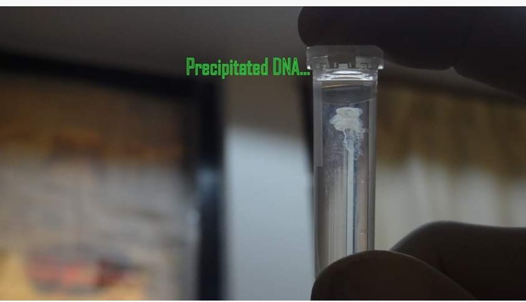 Different types of DNA extraction method