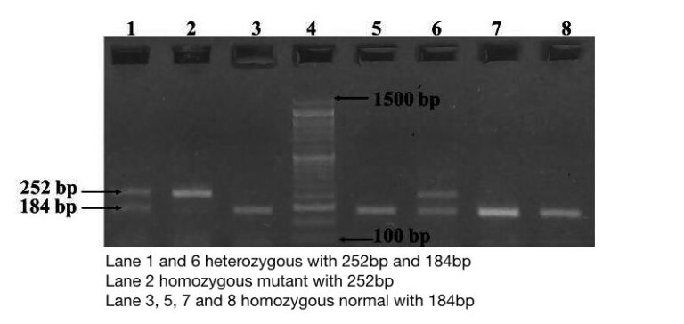 Part 2 Analysing And Interpreting Agarose Gel Electrophoresis Results