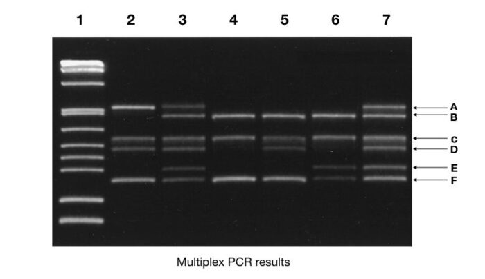 Part 2 Analysing And Interpreting Agarose Gel Electrophoresis Results