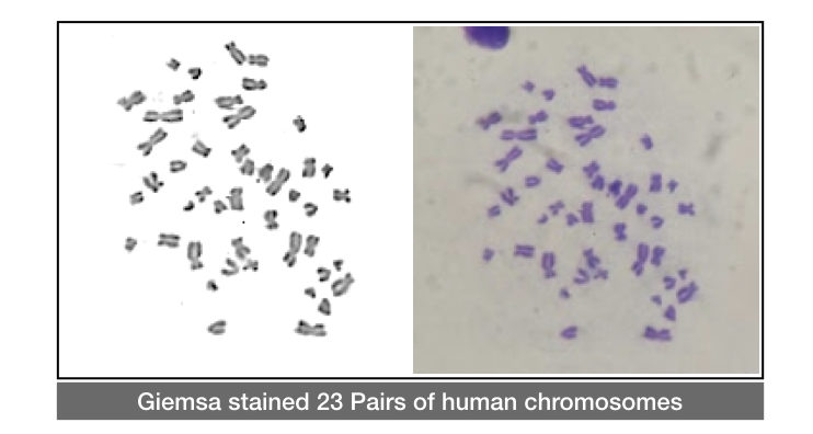 The giemsa stained chromosomes 