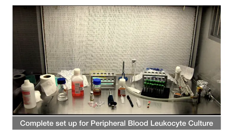 The Complete Protocol of Peripheral Blood Leukocyte Culture for karyotyping.