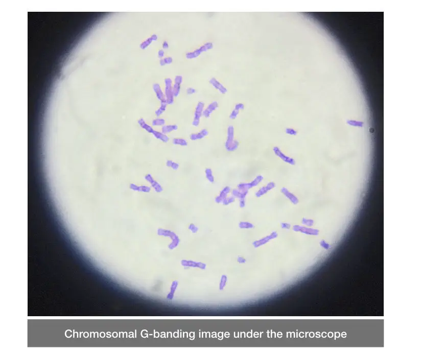 The image of Giemsa banded chromosomes directly taken from the microscope.