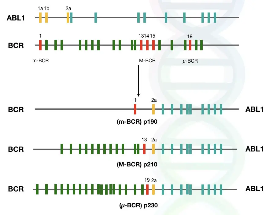 The BCR-ABL1 gene fusion at different location. 