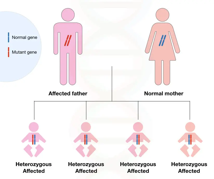 Image 3: graphical illustration of inheritance Huntington's disease. 