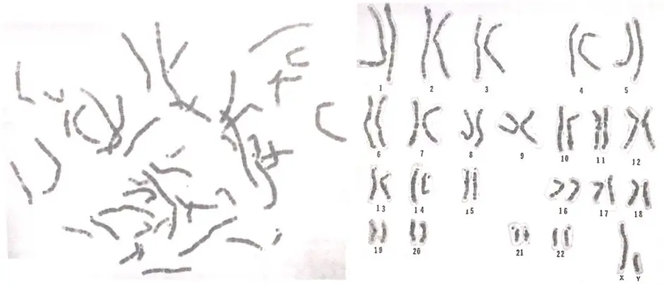 The elongated forms of colchicine treated chromosomes.