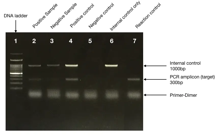 type-of-pcr-controls-negative-positive-and-internal-controls