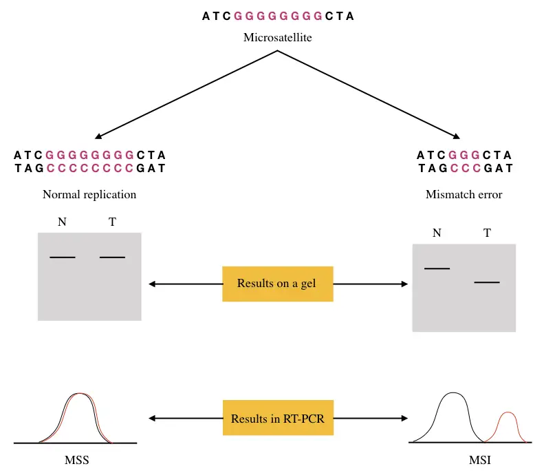 role-of-microsatellite-instability-msi-in-cancer-msi-h-msi-i-and