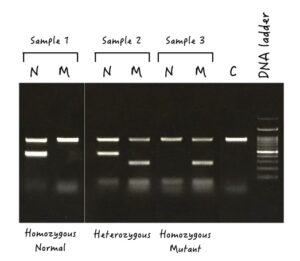 7 Ways To Determine Genotypes Using Gel Electrophoresis Genetic Education