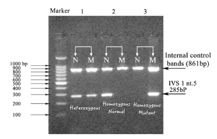 Illustration of genotyping of same-sized fragments in a gel. 
