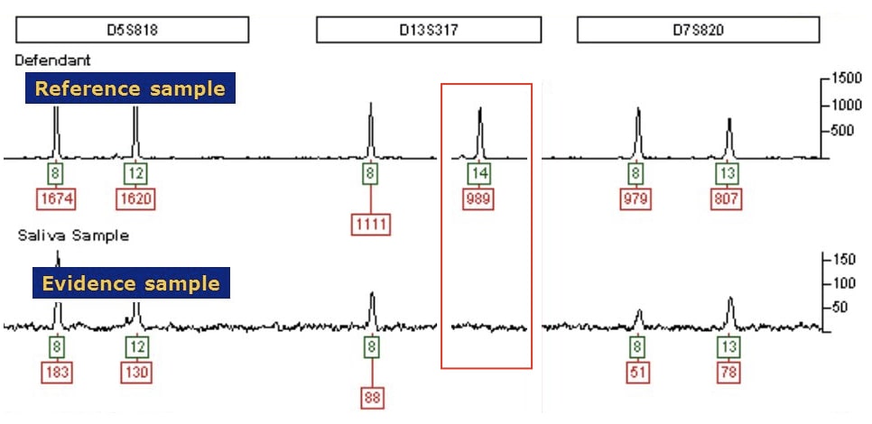 STR PCR allelic dropout image. 
