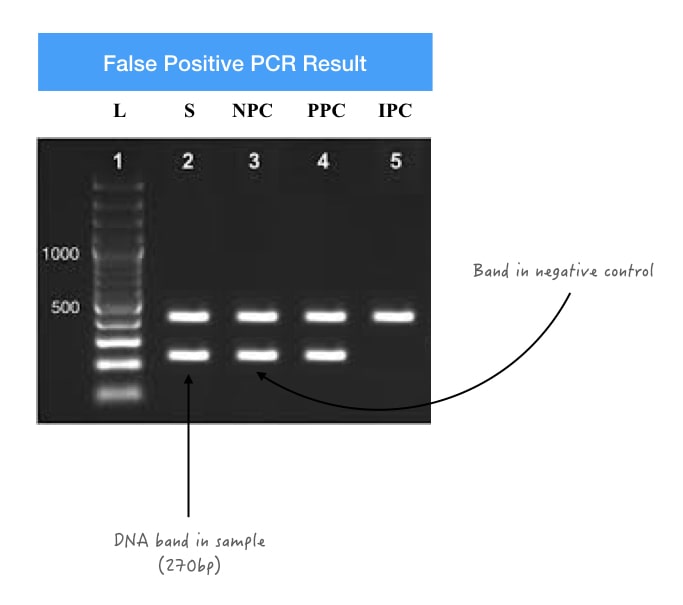 Representation of false positive PCR results. 