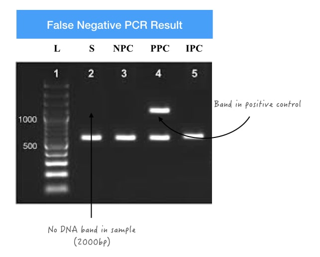Representation of false negative PCR results.
