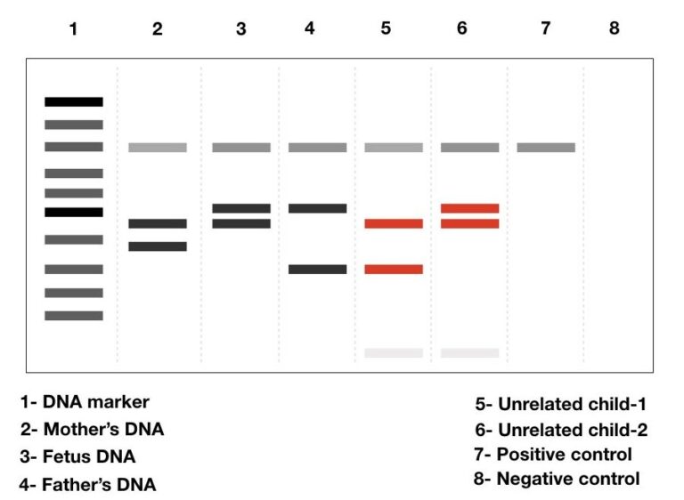 DNA Fingerprinting- Definition, Steps, Methods And Applications