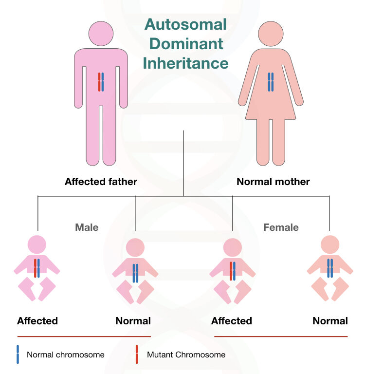 The inheritance pattern of autosomal dominant inheritance. 