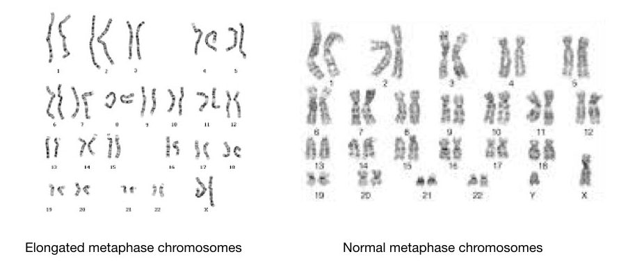 Normal and elongated chromosomes.
