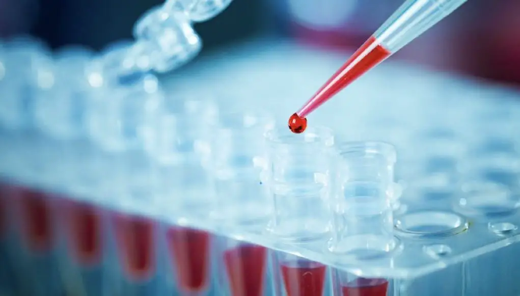 Different types of DNA extraction methods