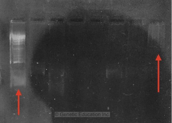 A complete guide for analysing and interpreting gel electrophoresis results