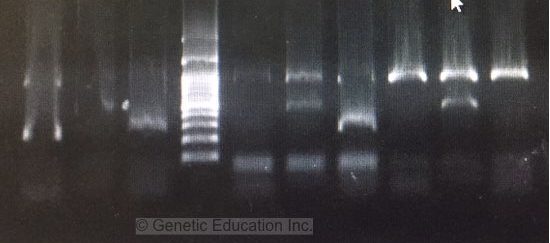 A complete guide for analysing and interpreting gel electrophoresis results
