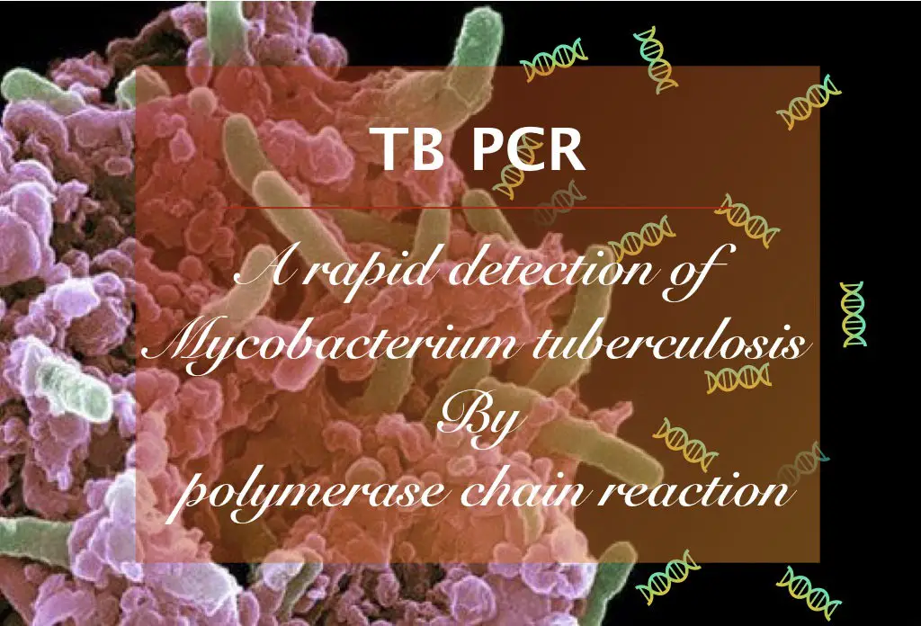 What is TB (Mycobacterium Tuberculosis) PCR?