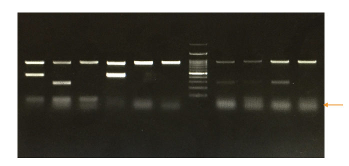 "Primer Dimer": Zones DNA amplification by pairing with foe