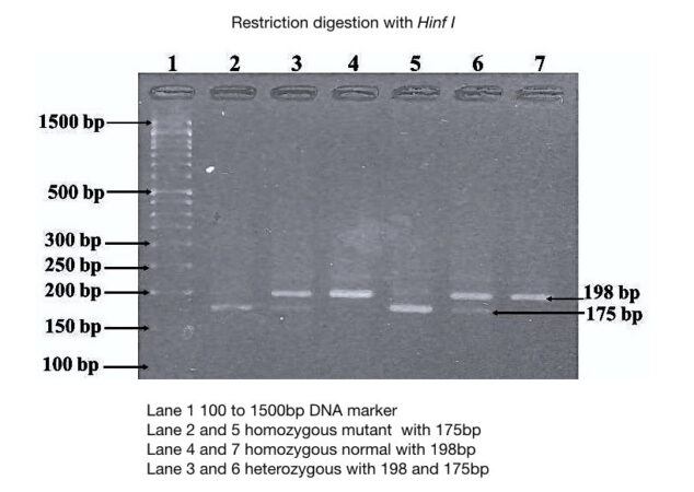 Part 2: Analysing And Interpreting (Agarose) Gel Electrophoresis Results