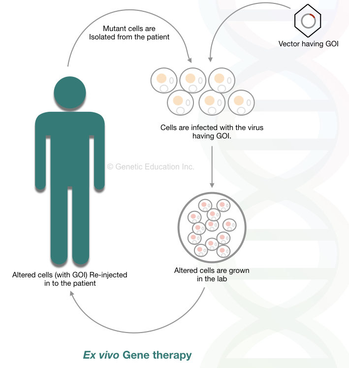 The method of ex vivo gene therapy