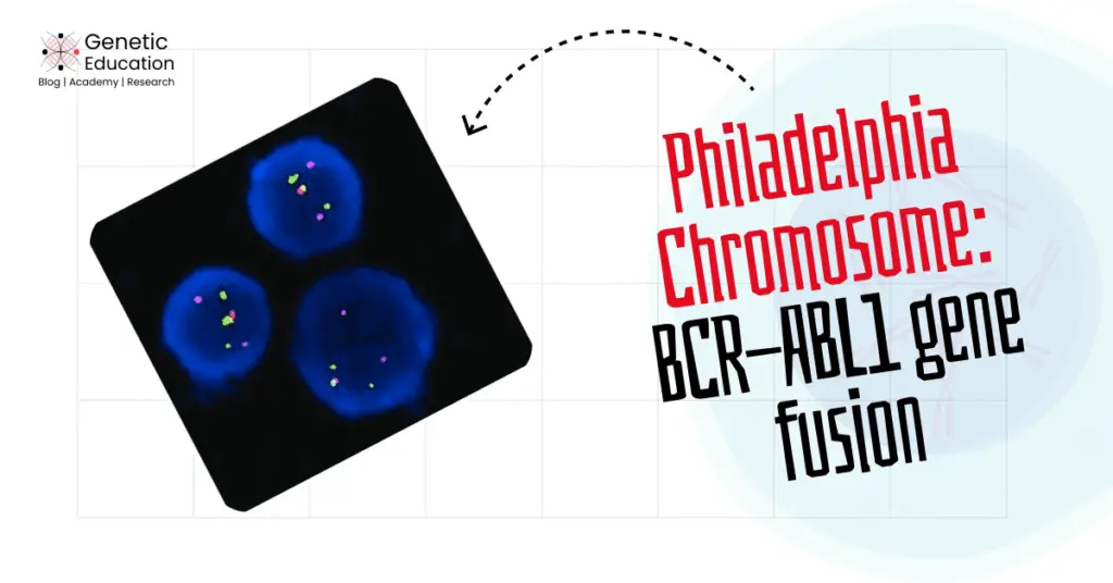 Philadelphia chromosome: BCR-ABL1 gene fusion