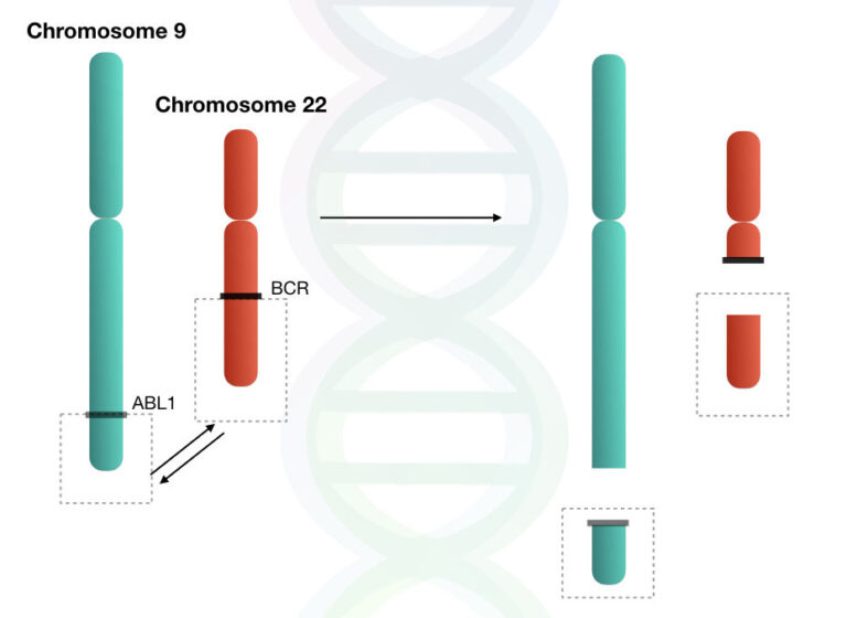 What is Philadelphia Chromosome? BCRABL1 Gene Fusion and CML