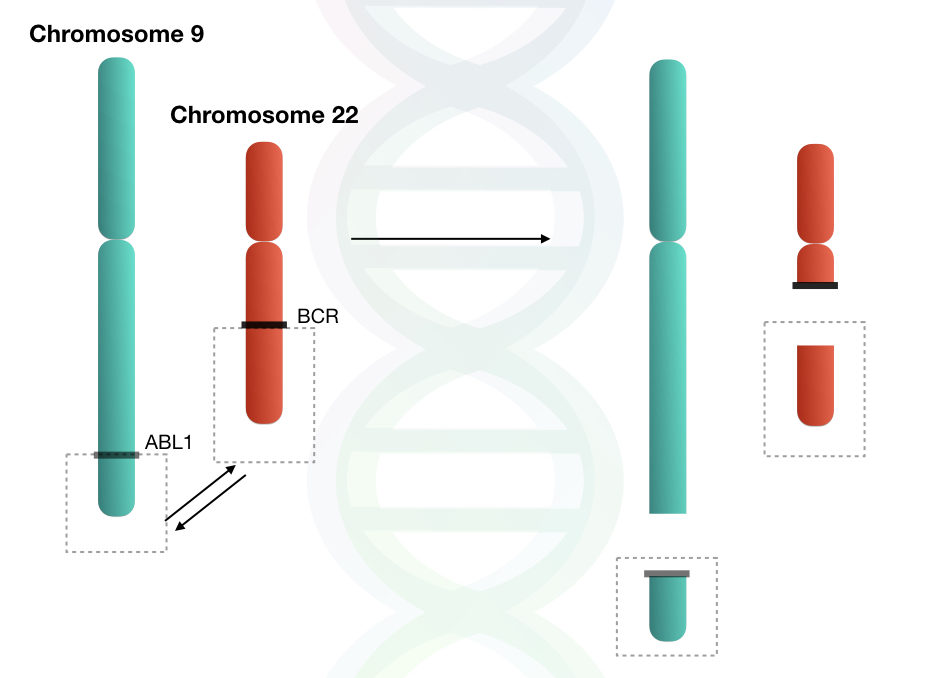 Reciprocal translocation between chromosome 9 and 22.