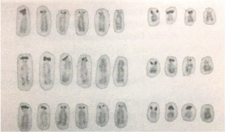 The acrocentric chromosomes showing the centromere banding.