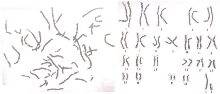 Karyotyping Definition Steps Procedure And Applications Genetic Education 3286