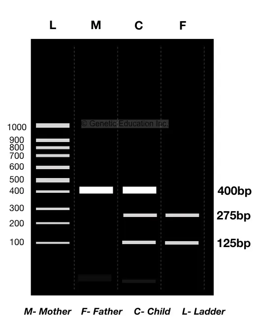 The gel image of paternity DNA testing.