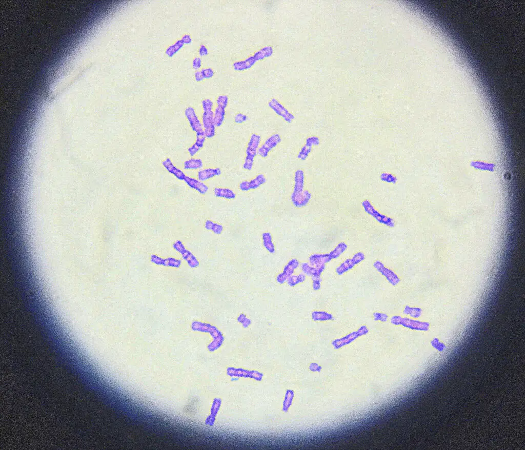 Chromosome field under the microscope