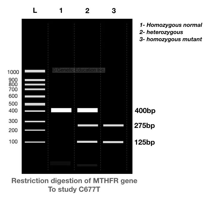 The hypothetical representation of restriction digestion of C677T with the restriction endonuclease.