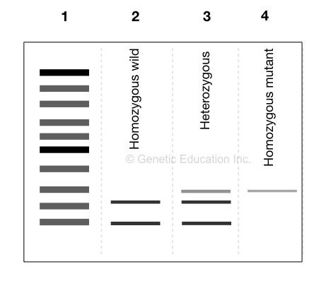 An illustration of gel image of restriction digestion. 