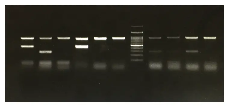 pcr troubleshooting band in negative control