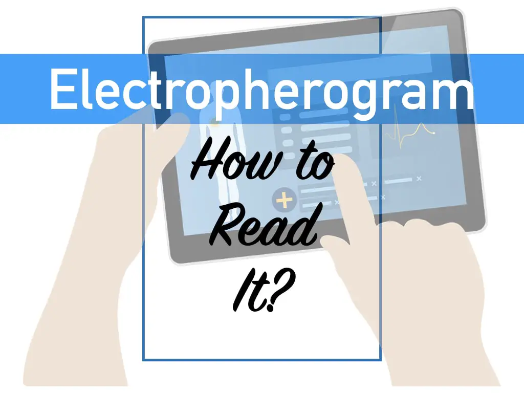 How to read electropherogram results?