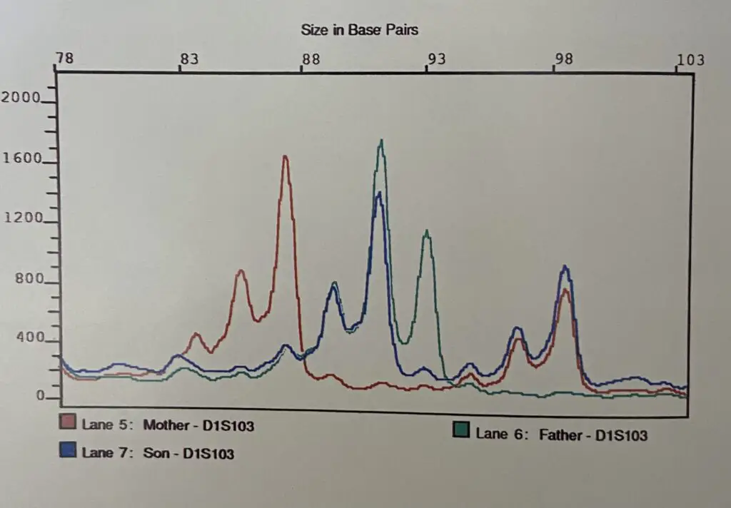 Electropherogram of Father, mother and son. 