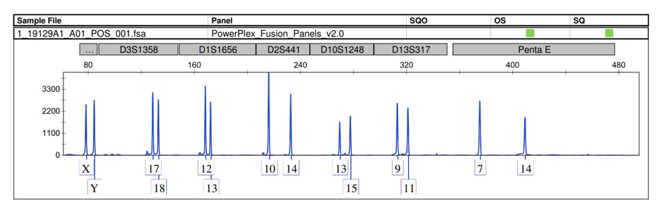 STR typing results. 