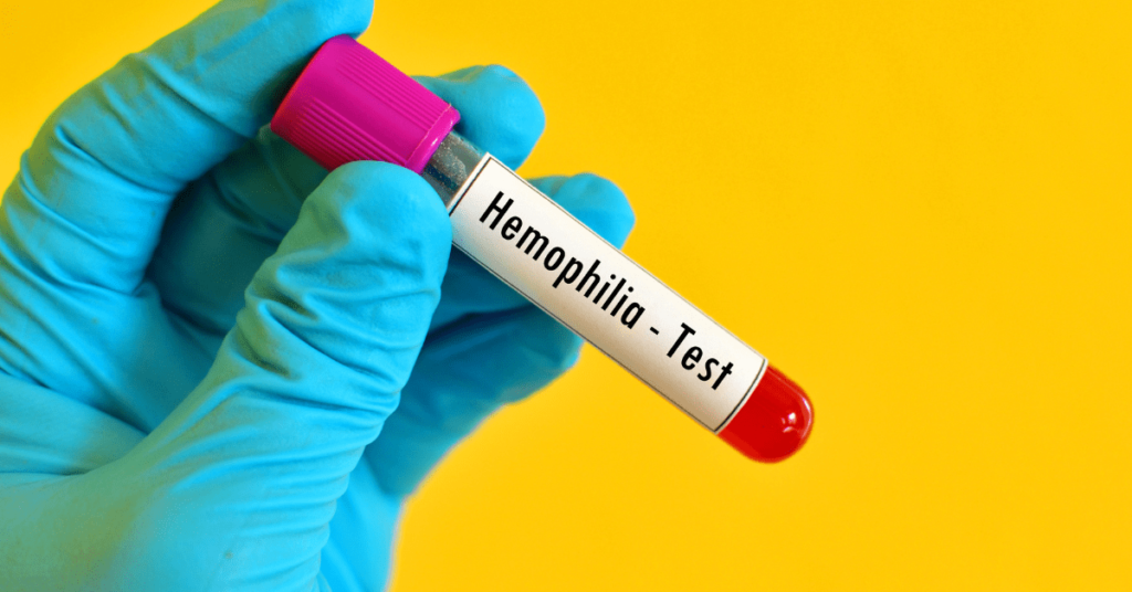 Recent research in hemophilia
