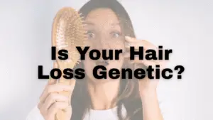 Image used to show hair loss and genetics