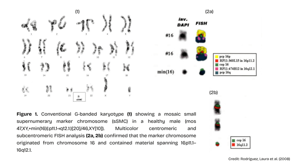 Image shows a karyotype and FISH results. 