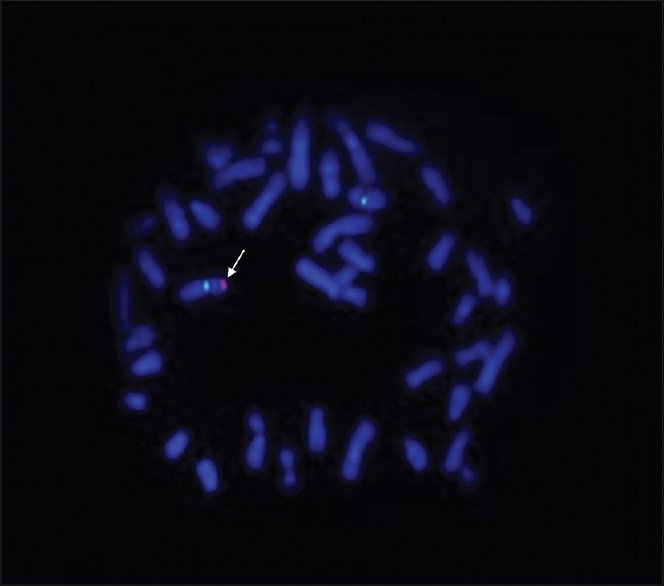 The real image of a FISH results