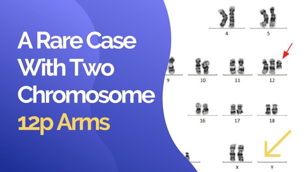 The study of isochromosome