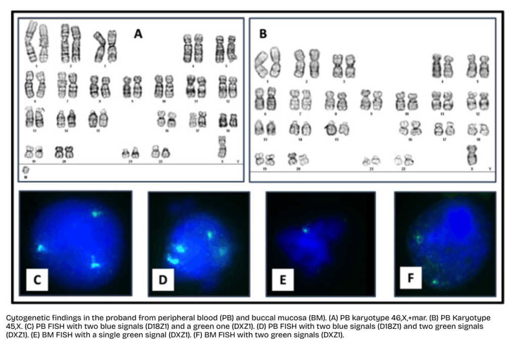 Image showing karyotyping and FISH results. 